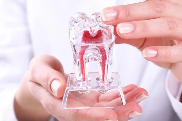 Foto de duas mãos segurando um molde de dente de acrílico.